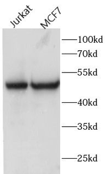 FAM20C Rabbit Polyclonal Antibody