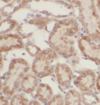 FAM20C Rabbit Polyclonal Antibody