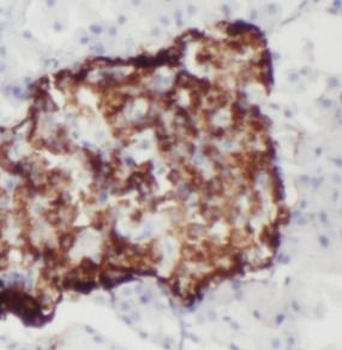 FAM3C Antibody