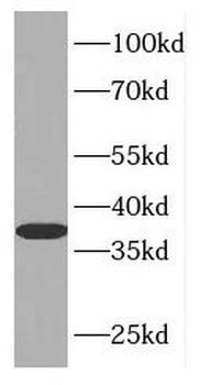 CYRIB Rabbit Polyclonal Antibody