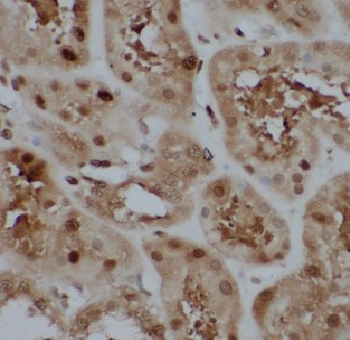 CYRIB Rabbit Polyclonal Antibody