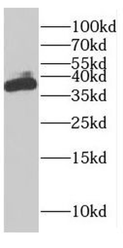 FAM76A Rabbit Polyclonal Antibody