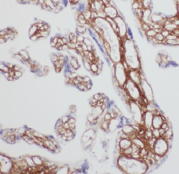 FAM76A Rabbit Polyclonal Antibody