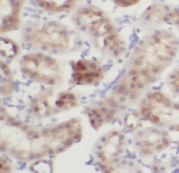 CIAO2B Rabbit Polyclonal Antibody