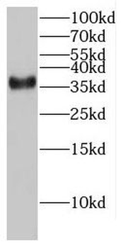 FAM98C Rabbit Polyclonal Antibody