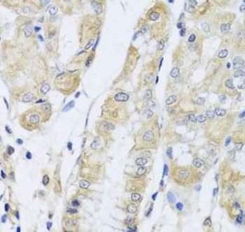 FANCA Rabbit Polyclonal Antibody