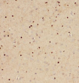 FANCC Rabbit Polyclonal Antibody