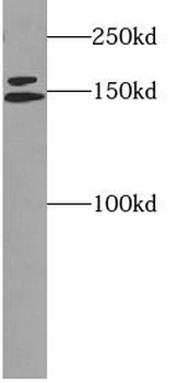 FANCD2 Rabbit Polyclonal Antibody