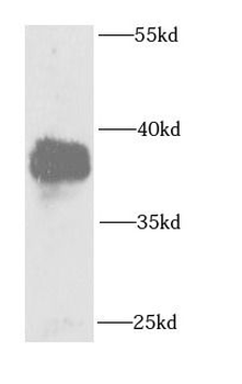 FANCL Rabbit Polyclonal Antibody