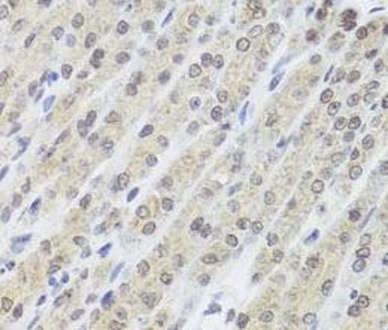 FANCL Rabbit Polyclonal Antibody