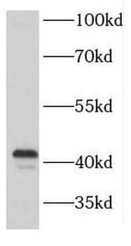 FANCL Rabbit Polyclonal Antibody