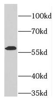 FARSA Rabbit Polyclonal Antibody