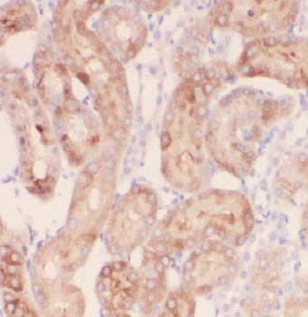 FARSA Rabbit Polyclonal Antibody