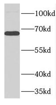 FARSB Rabbit Polyclonal Antibody