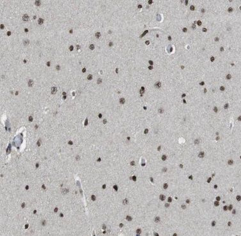FARSB Rabbit Polyclonal Antibody