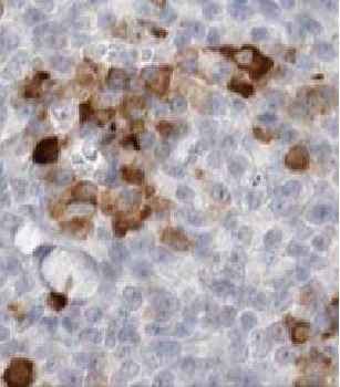 FSCN1 Antibody