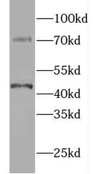 Slc27a4 Rabbit Polyclonal Antibody