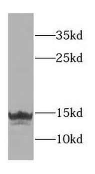 FAU Rabbit Polyclonal Antibody