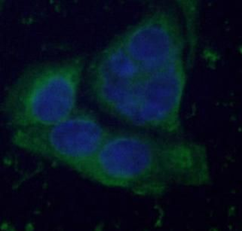 FBP1 Rabbit Polyclonal Antibody