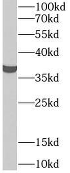 FBP1 Rabbit Polyclonal Antibody