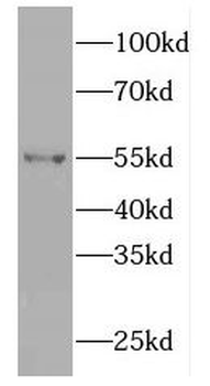 FBXO15 Rabbit Polyclonal Antibody