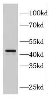 FBXL14 Rabbit Polyclonal Antibody