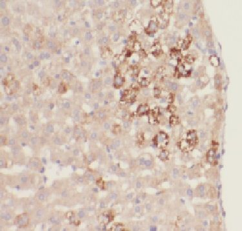 FBXL14 Rabbit Polyclonal Antibody