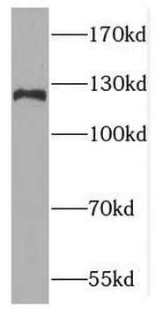 FBH1 Antibody