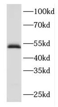 FBXO3 Rabbit Polyclonal Antibody