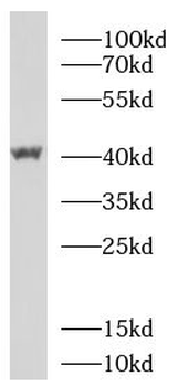 FBXO32 Antibody