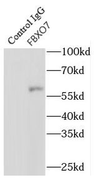FBXO7 Rabbit Polyclonal Antibody