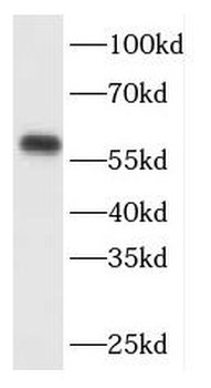 FBXO7 Rabbit Polyclonal Antibody