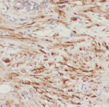FBXO7 Rabbit Polyclonal Antibody