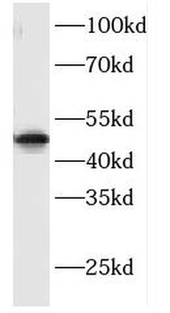 FBXO8 Rabbit Polyclonal Antibody