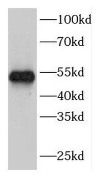 FBXW2 Rabbit Polyclonal Antibody