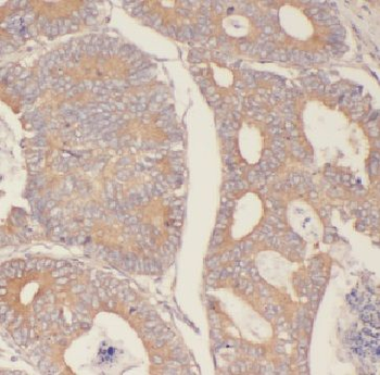 FBXW2 Rabbit Polyclonal Antibody