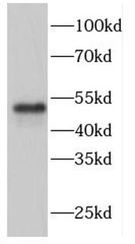 FBXW4 Rabbit Polyclonal Antibody
