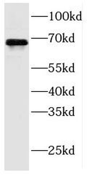 FDXACB1 Rabbit Polyclonal Antibody