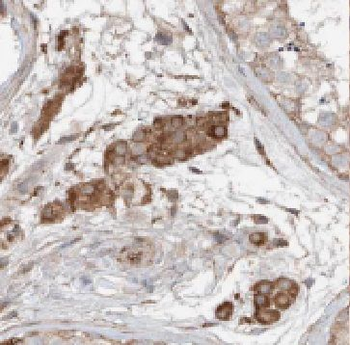 FDXACB1 Rabbit Polyclonal Antibody