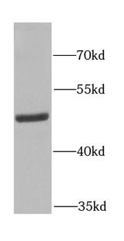 FECH Rabbit Polyclonal Antibody