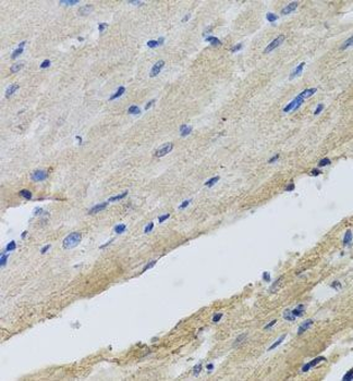 FECH Rabbit Polyclonal Antibody