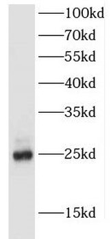 FEV Rabbit Polyclonal Antibody