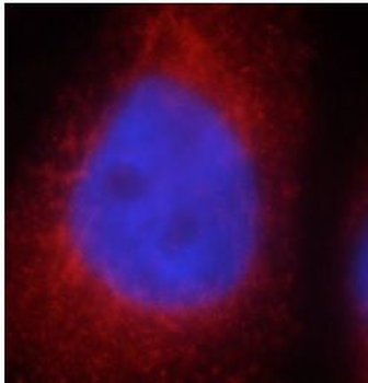 FGD5 Rabbit Polyclonal Antibody