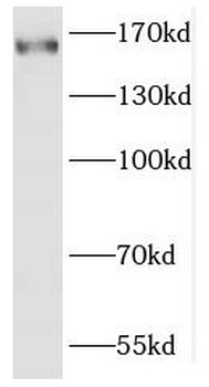 FGD5 Rabbit Polyclonal Antibody