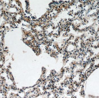 FGD5 Rabbit Polyclonal Antibody