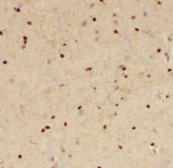 FGF12 Antibody