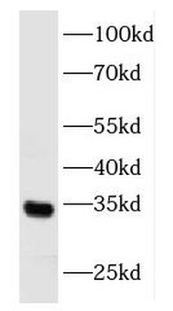 FGF17 Antibody