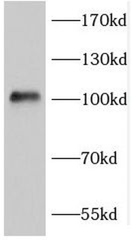 FGFR4 Antibody