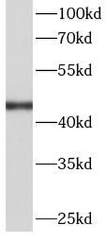 FH Rabbit Polyclonal Antibody