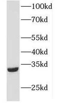 FHL2 Rabbit Polyclonal Antibody